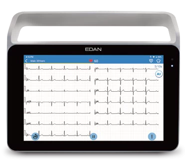 EDAN iSE 2